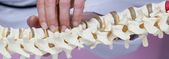 Chiropractic Fort Worth TX Facet Joint Syndrome Chiropractic Fort Worth TX Facet Joint Syndrome