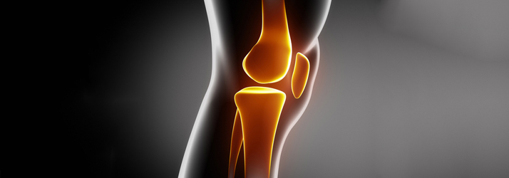 Chiropractic Fort Worth TX Osteoarthritis