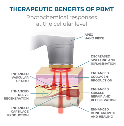 Chiropractic Fort Worth TX PBMT Graphic