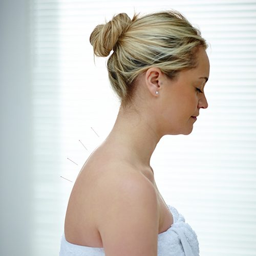 Chiropractic Fort Worth TX Acupuncture Relaxing Treatment Chiropractic Fort Worth TX Acupuncture Relaxing Treatment